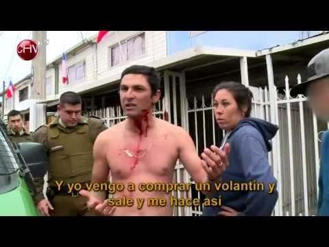 Pelea de vecinos terminó con uno de ellos con gran herida en la cara - ALERTA MÁXIMA