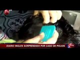 Diario inglés se sorprendió por caso extremo de piojos de niña chilena - CHV Noticias