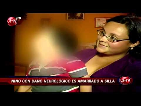 Revelan indignante maltrato en contra de menor con daño neurológico en colegio - CHV Noticias