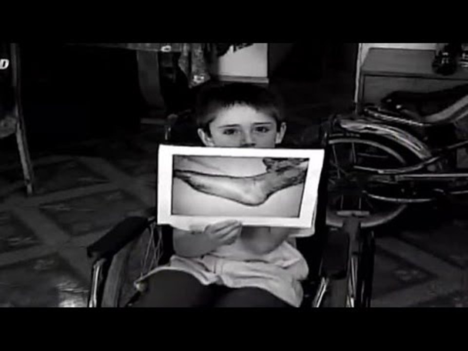 Niño se quemó con las brasas que tiró un panadero a la calle - CHV Noticias