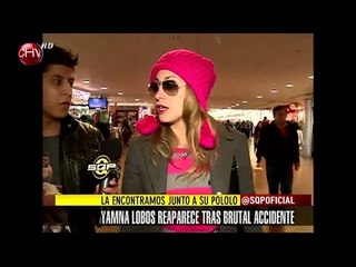 ¡Vimos a Yamna Lobos a 8 días de su accidente! - SQP