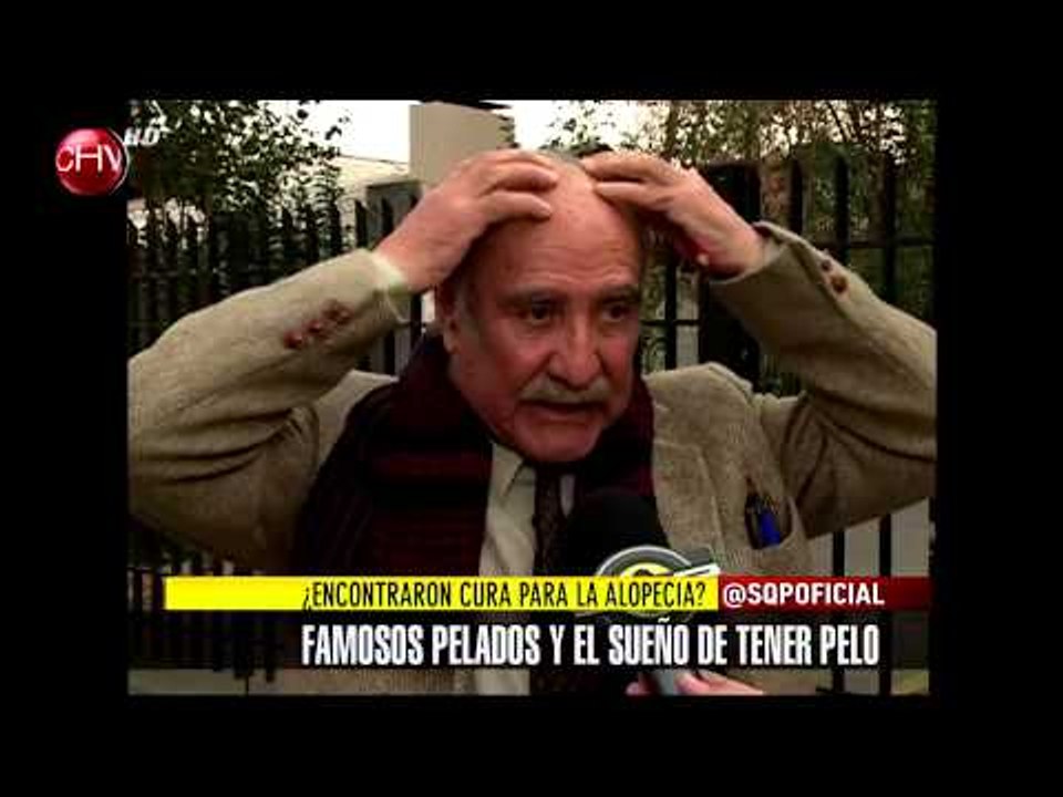 ¿Crees qué los hombres calvos sueñan con volver a tener pelo? - SQP