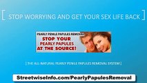 Pearly Penile Papules Removal - Remove Pearly Penile Papules Without Surgery