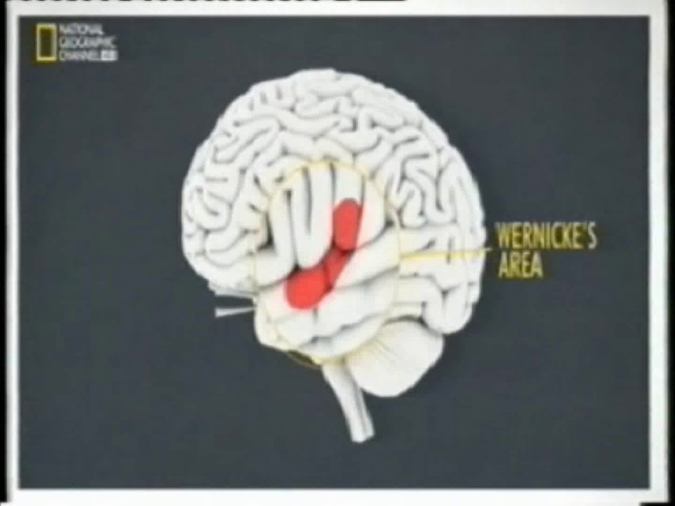 Cerebro: Area de Wernicke