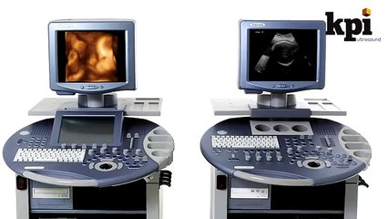 GE Voluson 730 ultrasound machine review & ratings SE