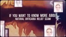 Natural Urticaria Relief SCAM -- Natural Urticaria Hives Treatment