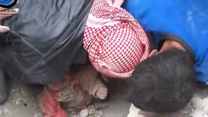 God Save Little Child after Bomb Blasting in Meddle East