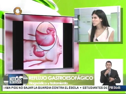 Tratamiento para el reflujo gastroesofágico tiene 2 vertientes