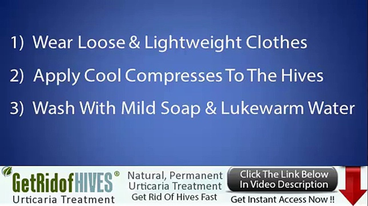 How To Get Rid of Hives Fast - Top 3 Natural Ways