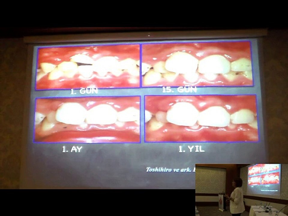 PROF.DR.AYŞE NİL ALTAY 25 EYLÜL 2014 ADO EĞİTİM SEMİNERİ 1