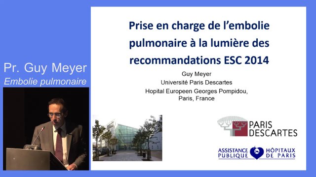 Prise en charge de l'embolie pulmonaire et recommandations ESC 2014. Guy Meyer