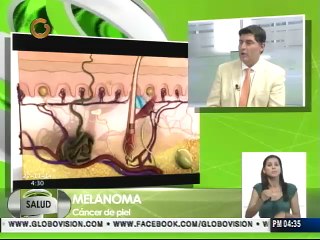 Autoexamen disminuye en 44% posibilidad de padecer melanoma