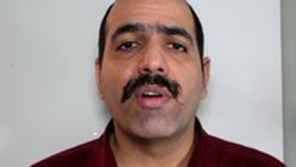 Some painful mustache removal methods