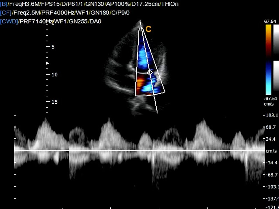 Q5-CardiacCW-2
