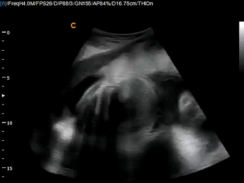 Q5-Fetal-2