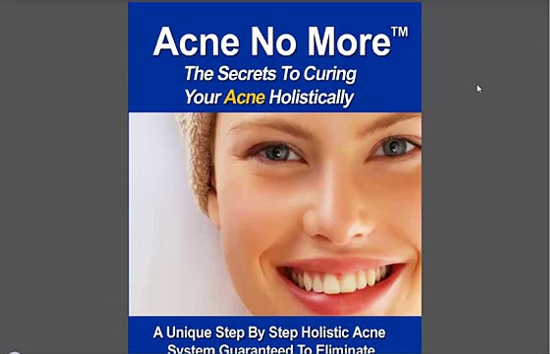 Acne No More Mike Walden PDF Free Download