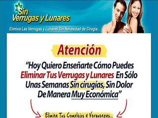 Download Video: Sin Verrugas y Lunares de Manuel Alfonso Lucas