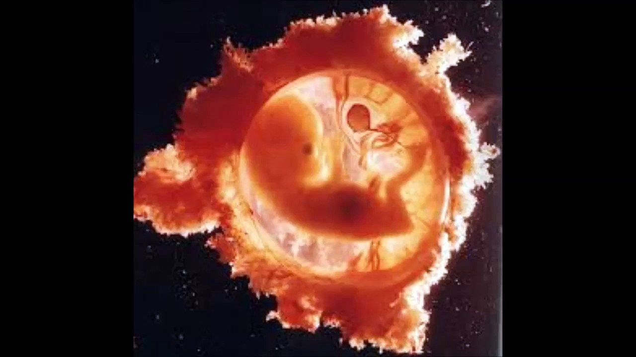 BEBE PLEURE  (Baby cries) Aurore Poret