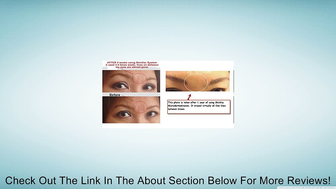 UltraRadiance: SkinVacMD "Forever" Diamond Microderm Tip for Face Toning, Neck Firming, Chest, & Hands use for Best Microdermabrasion (Accessory requires microderm machine and wand) Review