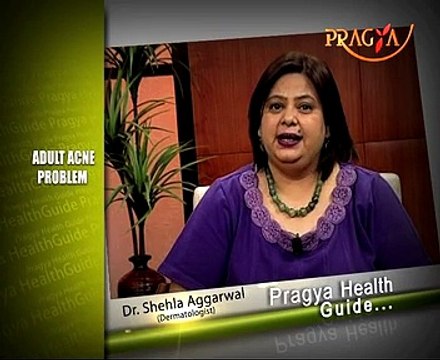 Adult Acne Problem-Dr. Shehla Aggarwal(Dermatologist)-Skin Care Alert