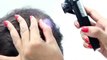 PRP Hair Loss Treatment in Bangalore - Platelet Rich Plasma Hair Fall Treatment - Oliva Clinic