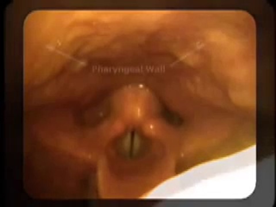 Anatomical Tutorial During Trans-Nasal Endoscopy