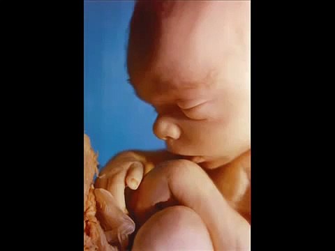 Ravi Zacharias Q A Abortion and Free Will