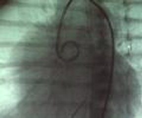 Salih Bebek "en küçük vaka"  olarak literatüre girdi