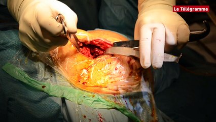 Lorient. La clinique du Ter limite les saignements au bloc !