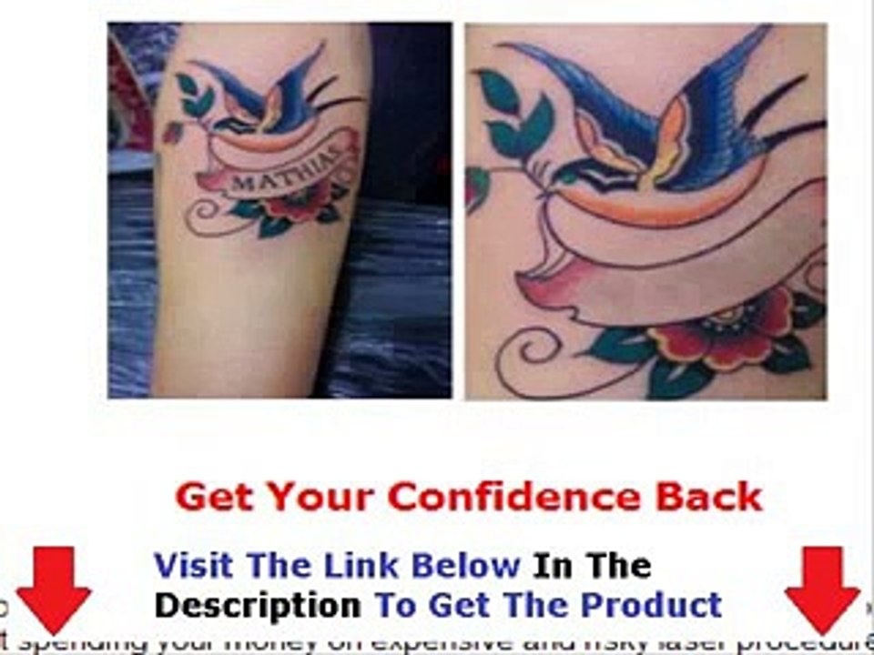 Get Rid Tattoo  THE SHOCKING TRUTH Bonus + Discount