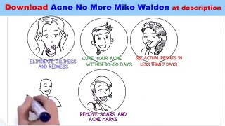 Mike Walden Acne No More PDF Free Download