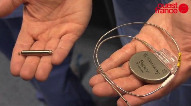 Le CHU de Rennes expérimente un pacemaker miniature qui va révolutionner la chirurgie cardiaque