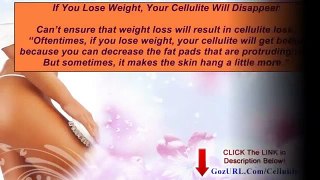 The Truth About Cellulite