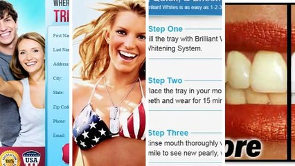 Great teeth whitening solution