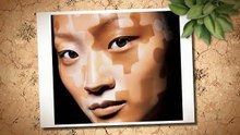 Vitiligo Prevention - Natural Vitiligo Treatment System