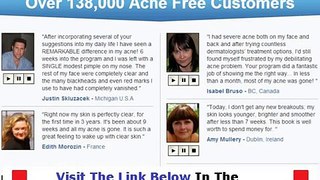 Acne No More Product + DISCOUNT + BONUS