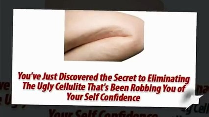 Natural Cellulite Treatment - Cellulite Factor Review