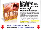 Banish Tonsil Stones + DISCOUNT + BONUS