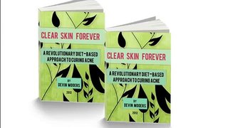 dry skin acne natural treatment - Clear Skin Forever