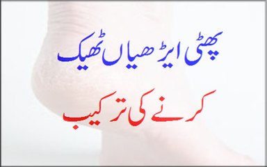 Cracked Heels Theek Karnay Ki Tarkeeb