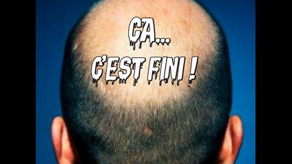 Terminé la calvitie ? Test en direct !!