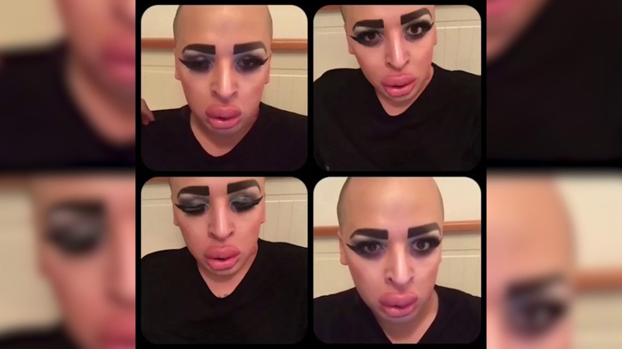 Il dépense plus de 100 000 € pour ressembler à Kim Kardashian