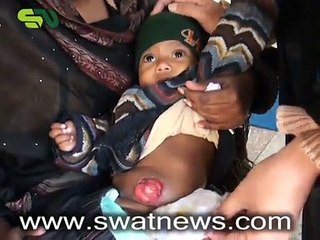 Khwendo jirga--مسیحی برادری کی بچی انت کی بیماری میں مبتلا -