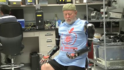 Double amputee controls two robotic arms with his mind