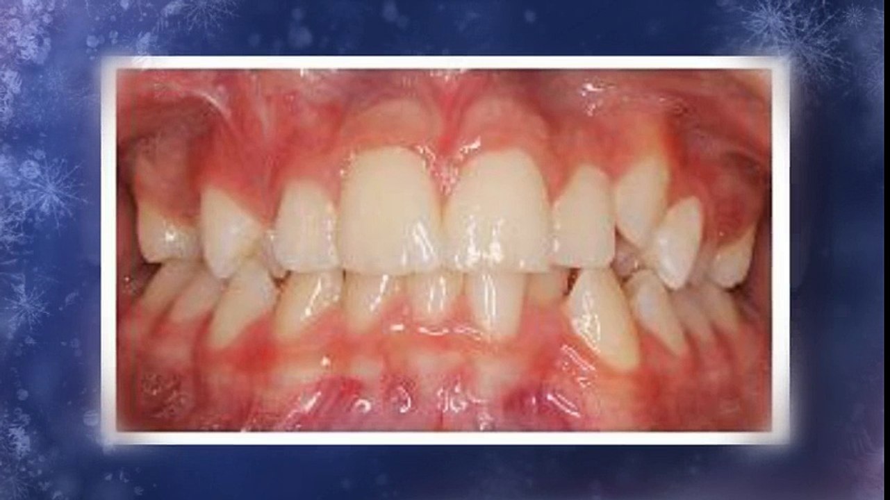 Ebert Fort Collins Orthodontists - (970) 490-6065