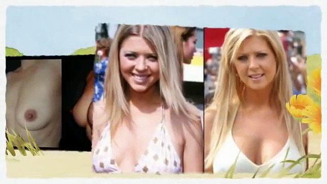 aumento de busto cirugia+Aumento De Busto