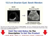 Ovarian Cyst Miracle Discount Bonus   Discount