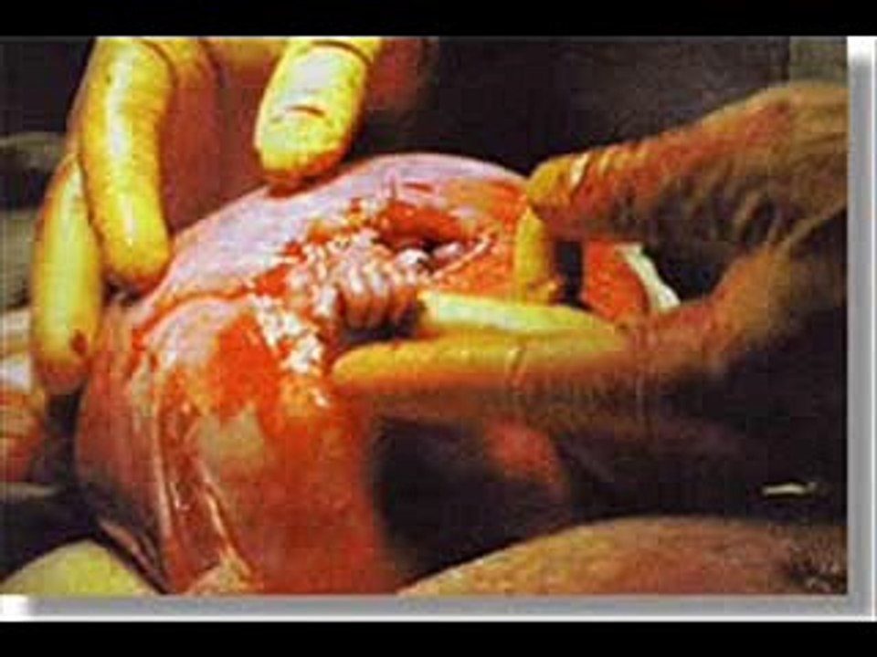 El aborto no es la solución para la delincuencia
