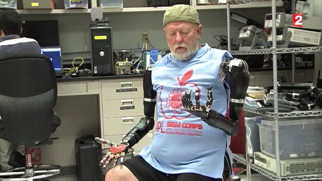 Il dirige ses bras bioniques par la pensée