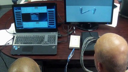 A double amputee uses two ultra- futuristic robot arm - Tech